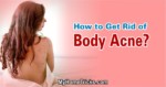 How to Get Rid of Body Acne